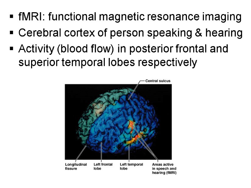 fMRI: functional magnetic resonance imaging Cerebral cortex of person speaking & hearing Activity (blood